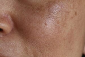 how to take care of dry skin