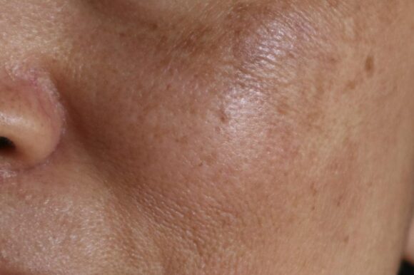 how to take care of dry skin